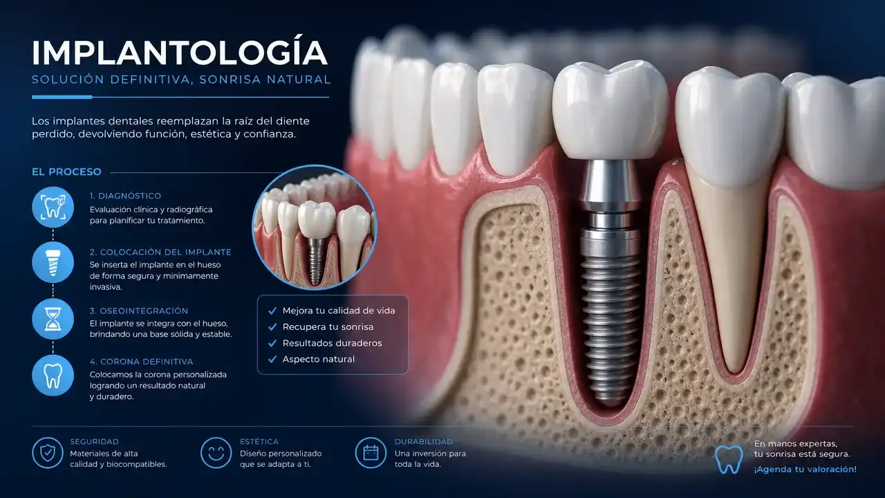 especialista implantologia ripollet
